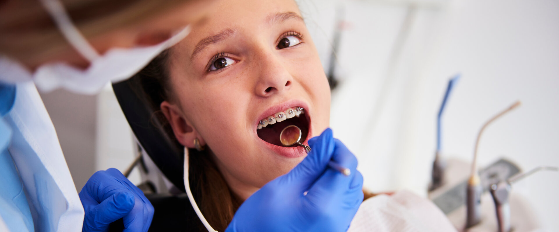 Kiedy Z Dzieckiem Do Ortodonty Sprawdź W Jakim Wieku Umówić Pierwszą Wizytę 8421